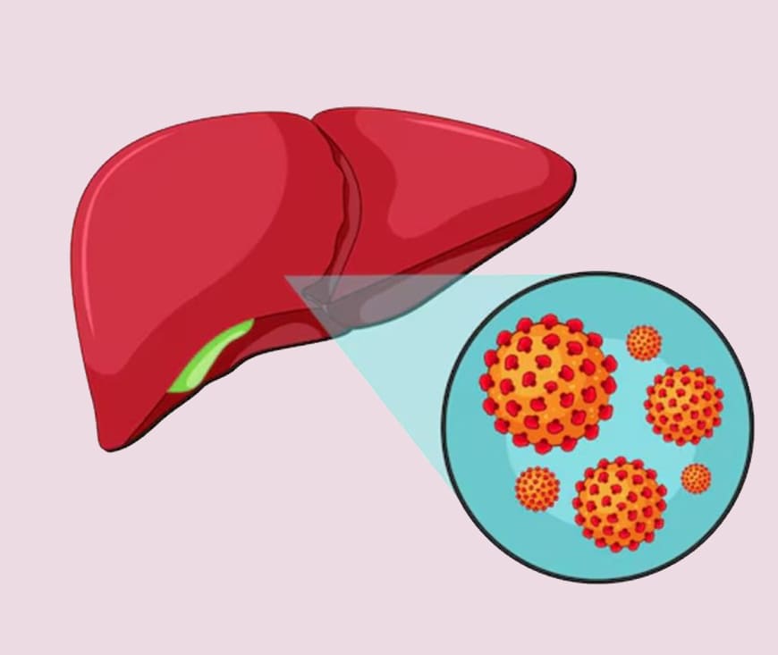 Hepatitis Treatment